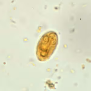 Giardia_cyst_wtmt3.jpg