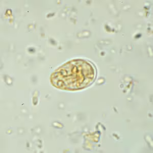 Giardia_cyst_wtmt4.jpg
