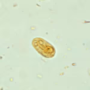 Giardia_cyst_wtmt5.jpg