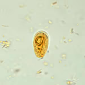 Giardia_cyst_wtmt6.jpg