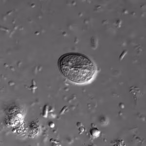 Giardia_cyst_dic.jpg