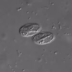 Giardia_cyst_dic2.jpg
