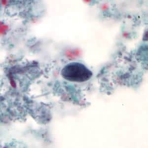 Giardia_cyst_tric.jpg