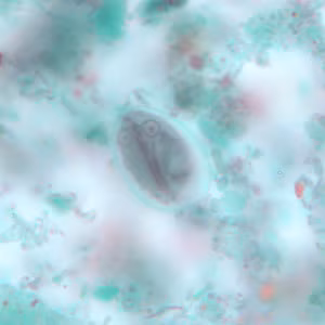 Giardia_cyst_tric10.jpg