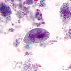 Giardia_cyst_tric2.jpg