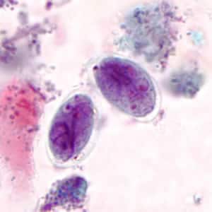Giardia_cyst_tric3.jpg