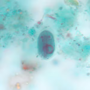 Giardia_cyst_tric4.jpg