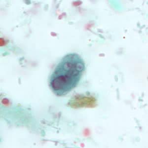 Giardia_cyst_tric5.jpg