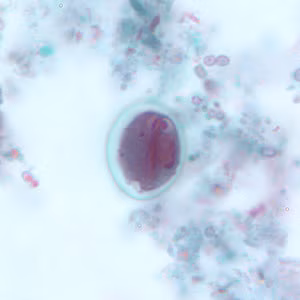 Giardia_cyst_tric7.jpg