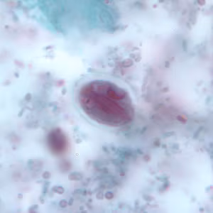 Giardia_cyst_tric8.jpg
