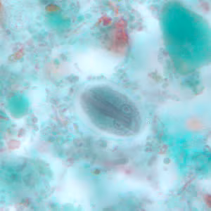 Giardia_cyst_tric9.jpg