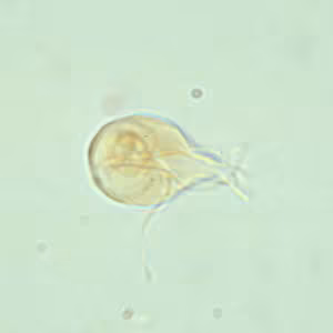 Giardia_troph_wtmt.jpg