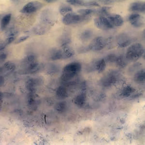 Giardia_troph_VT.jpg