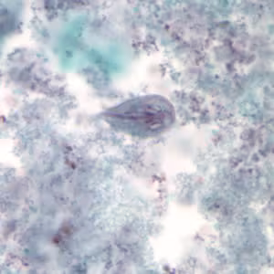 Giardia_troph_tric.jpg