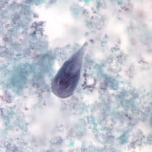Giardia_troph_tric2.jpg