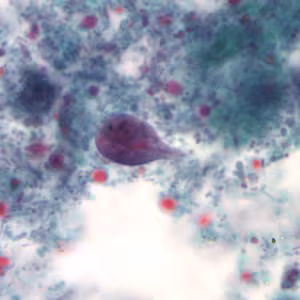 Giardia_troph_tric3.jpg