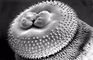 gnathostoma1.jpg Figure A