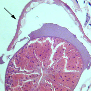 Gnathostoma_China_HE1.jpg Figure A