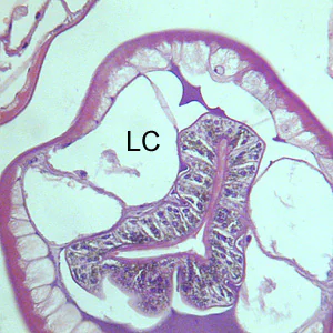 Gnathostoma_China_HE2.jpg Figure B