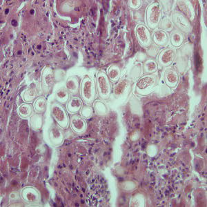 C_hepatica_eggs_200x_HB.jpg