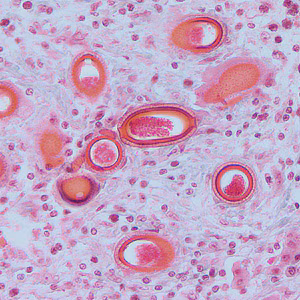 C_hepatica_tissue_HB.jpg