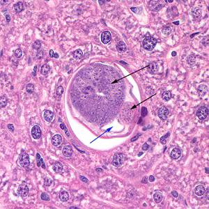 C_hepatica_400x_male_liver.jpg