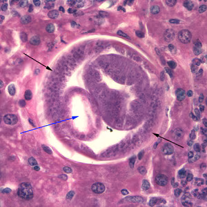 C_hepatica_500x_liver.jpg