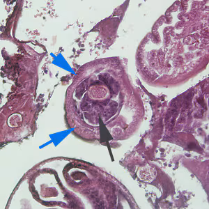 C_hepatica_adult_200x_HB.jpg