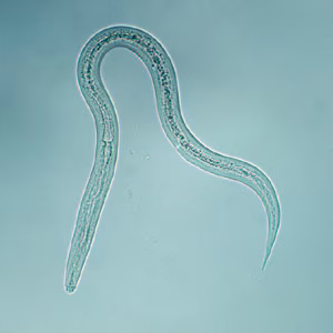 Hookworm_filariform_B.jpg Figure B