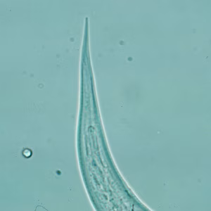 Hookworm_filariform_posterior_A.jpg Figure D