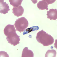Case147_A.jpg