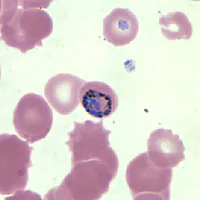 Case147_C.jpg