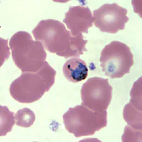 Case147_D.jpg