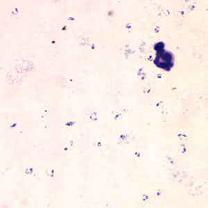 Case153_A.jpg