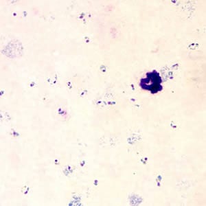 Case153_B.jpg