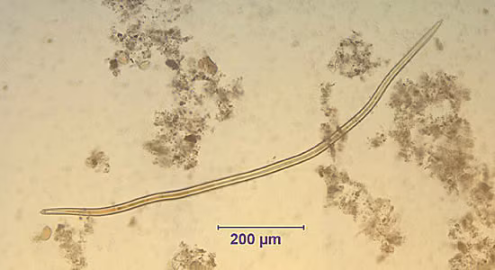 Case155_A.jpg