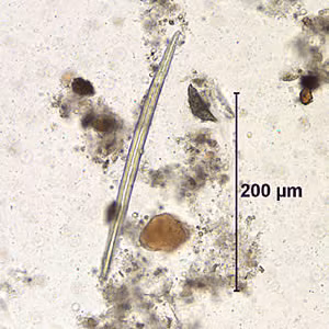Case155_B.jpg