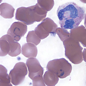Case157_A.jpg