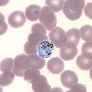 Case157_B.jpg