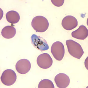 Case157_C.jpg