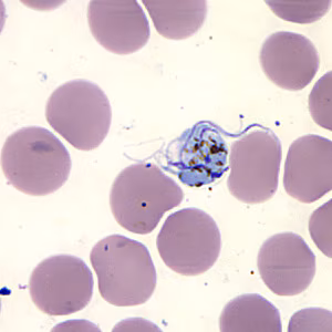Case157_E.jpg