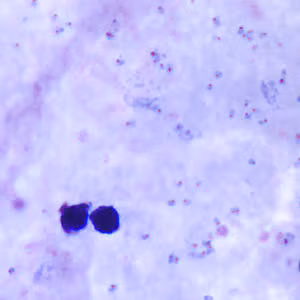 Case160_A.jpg