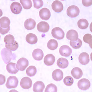 Case160_C.jpg