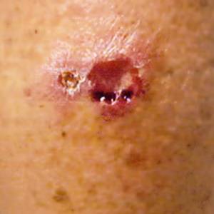 Case164_A.jpg