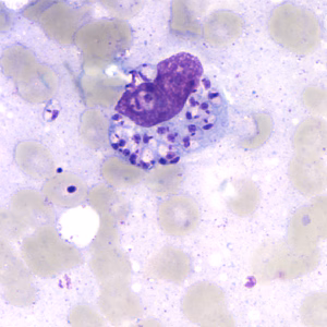 Case164_B.jpg
