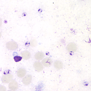 Case164_C.jpg