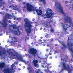 Case164_D.jpg