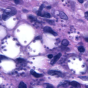 Case164_E.jpg