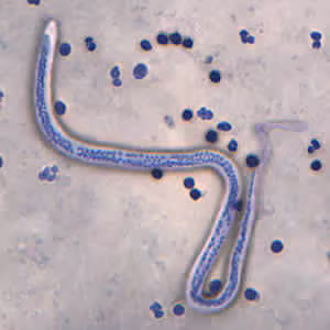 Case168_A.jpg