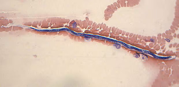 Case168_C.jpg